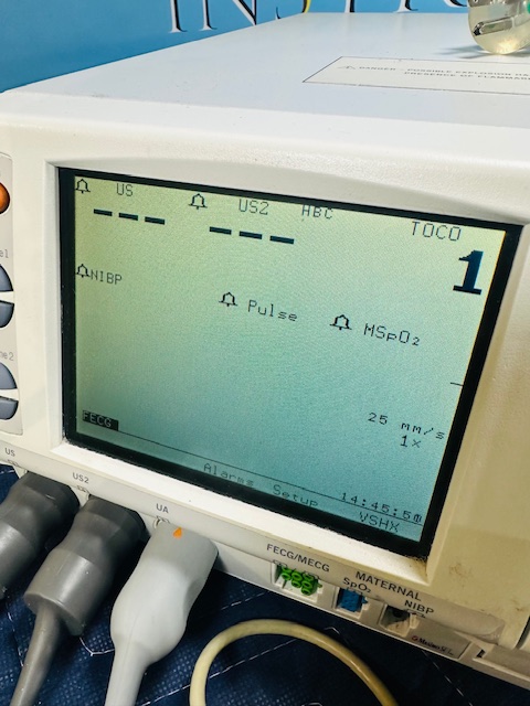 GE 250 SERIES 259C FETAL MONITOR W/ Toco Transductors (B804) - Image 22