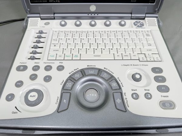 GE LOGIQ e Portable Ultrasound 11/2006 No Probes/PSU, Battery Incl. R4.0.4 (C142) - Image 18