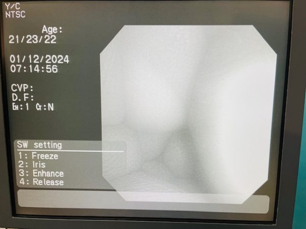 OLYMPUS PCF-160AL VIDEO COLONOSCOPE (B738) - Image 28
