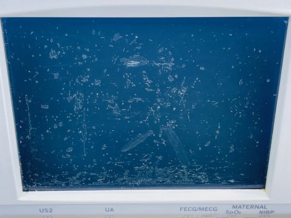 GE MEDICAL SYSTEM 250 SERIES 259CX-A FETAL MONITOR (B839-40) - Image 2