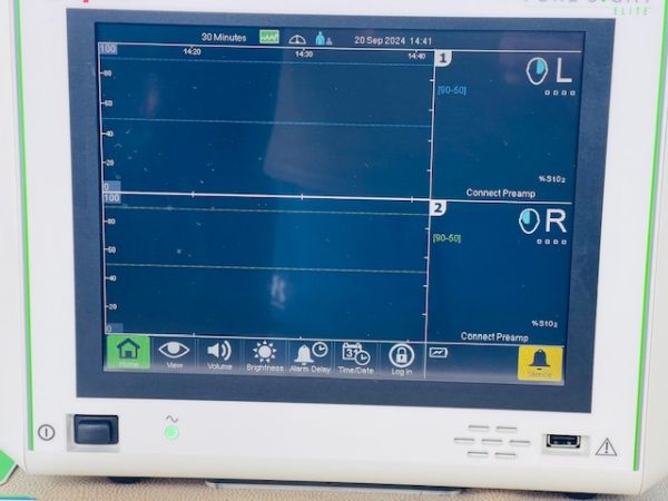 CASMED FORESIGHT ELITE 01063000, ABSOLUTE Monitor (B918) - Image 13