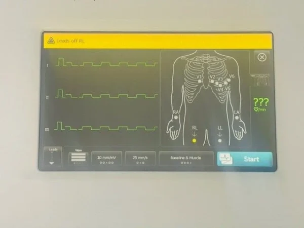 Welch Allyn CP150 EKG ECG Electrocardiograph (B275) - Image 11