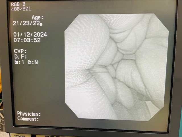 Olympus CF Type CF 140L Colonoscope (AS124) - Image 4