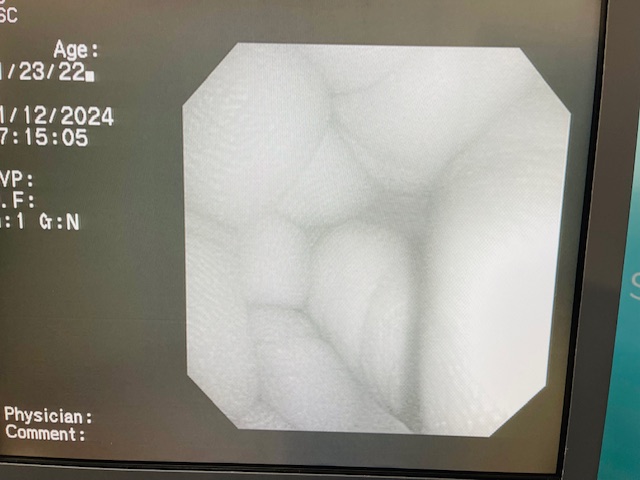 Olympus PCF-160AL Colonoscope (AS125) - Image 3