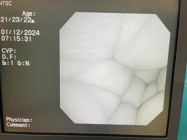 Olympus PCF-160AL Colonoscope (AS125) - Image 4