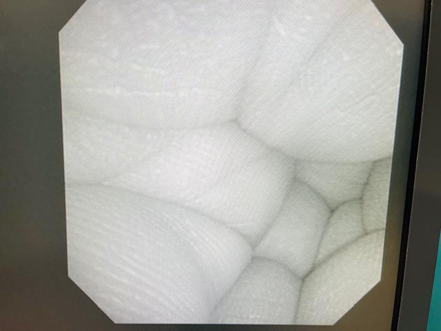 Olympus PCF-160AL Colonoscope (AS125) - Image 5