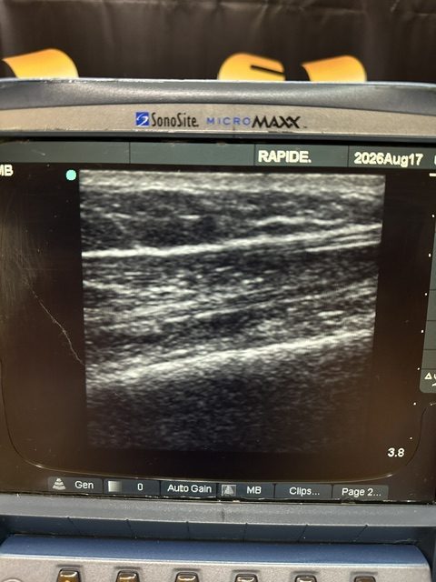Sonosite MicroMaxx Ultrasound System (C430) - Image 14
