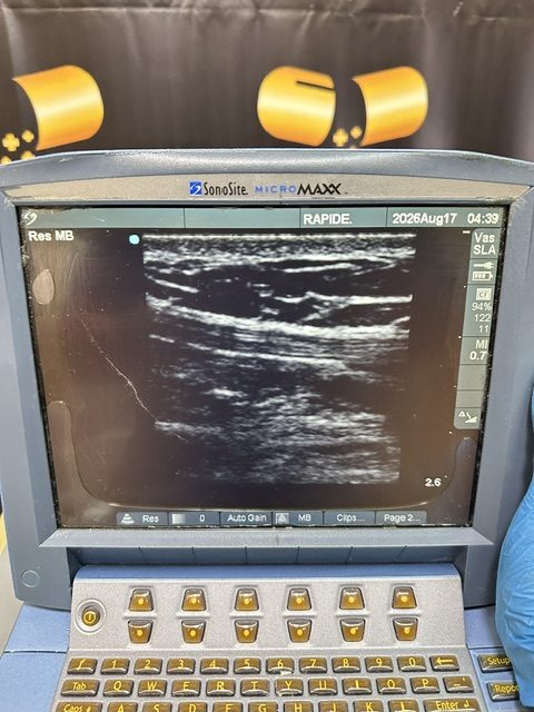 Sonosite MicroMaxx Ultrasound System (C430) - Image 16