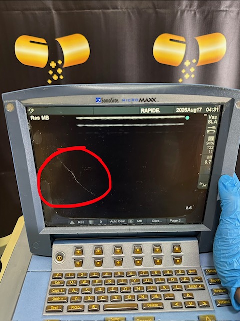 Sonosite MicroMaxx Ultrasound System (C430) - Image 19